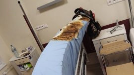 61-latek palił papierosa na Oddziale Chirurgii. Od niedopałka zapalił się materac na którym leżał!