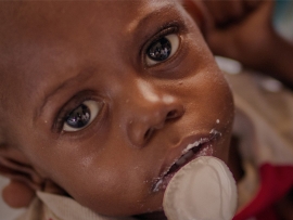 Sytuacja w Jemenie jest tragiczna. Największa na świecie epidemia cholery zabija dzieci
