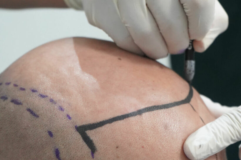 okulary przeciwsłoneczne