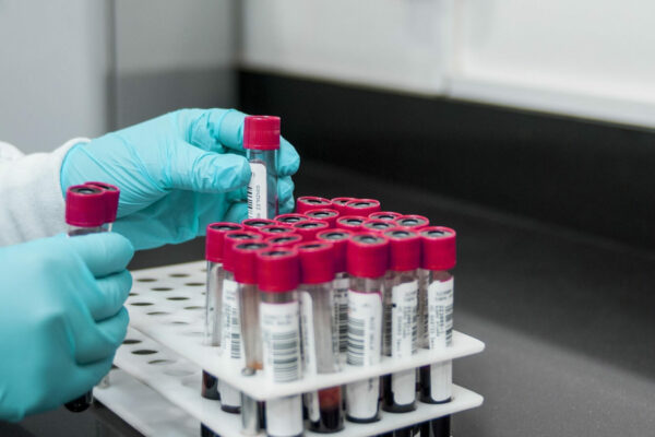 darmowy test HPV Lubuskie - rak szyjki macicy