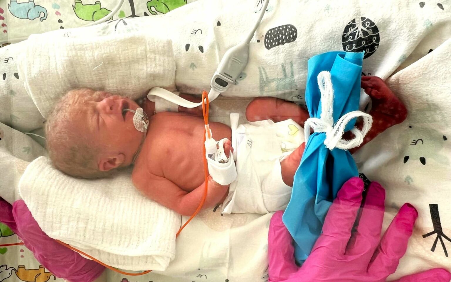 trojaczki Zielona G&oacute;ra - szpital Zielona G&oacute;ra neonatologia