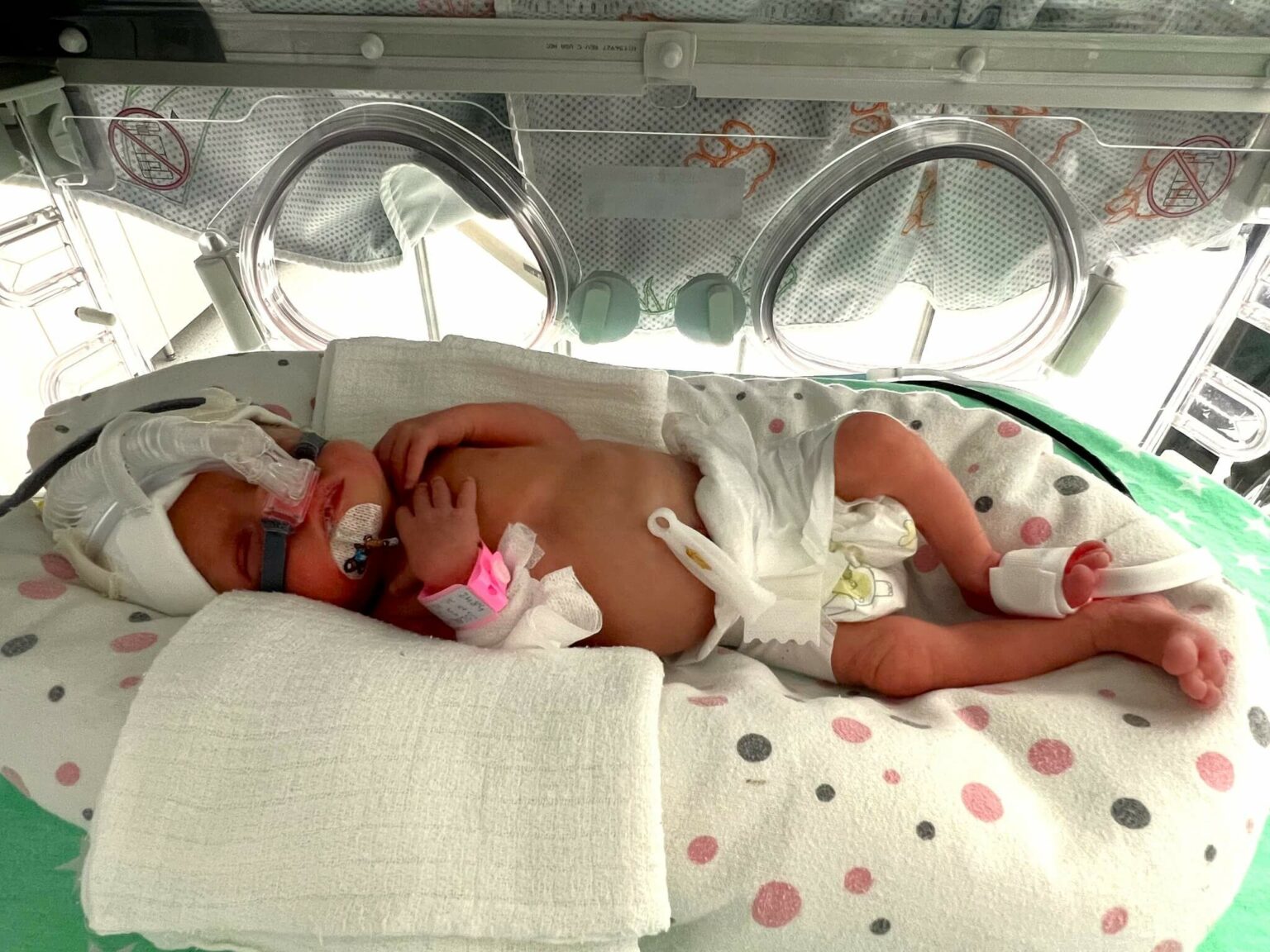 trojaczki Zielona G&oacute;ra - szpital Zielona G&oacute;ra neonatologia