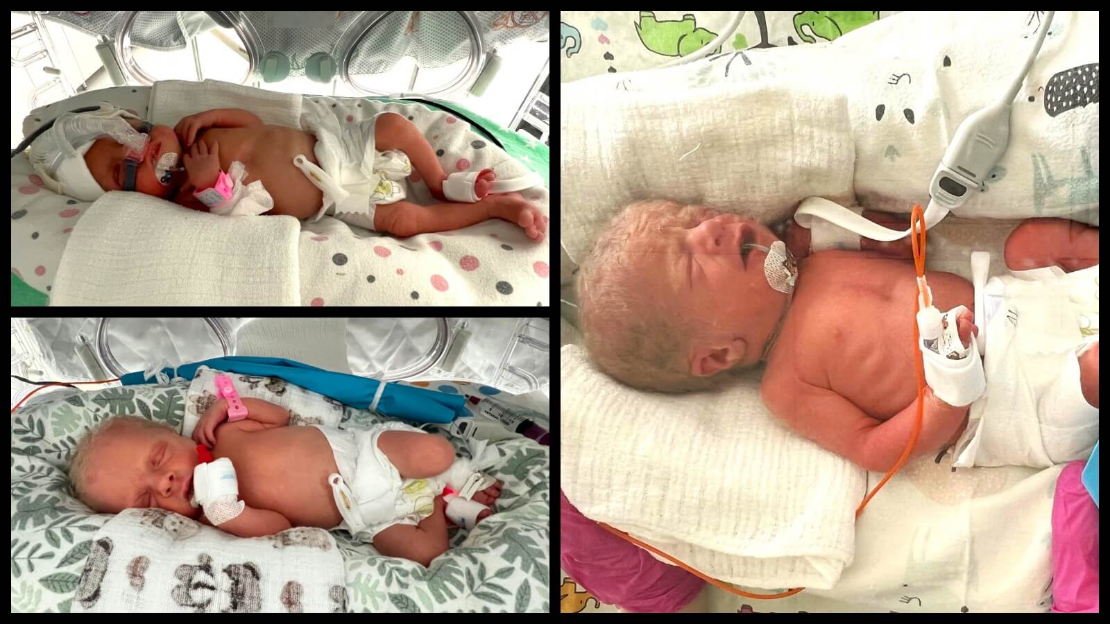 trojaczki Zielona Góra - szpital Zielona Góra porodówka